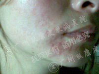 �����ݷ���Ƥ����ҽԺ��